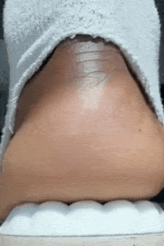 Plantaris Semelles Orthopédiques Mémoire de Forme